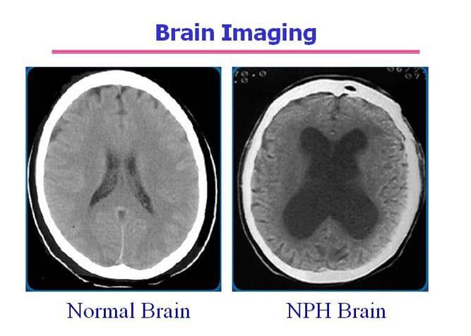 Brain Imaging Comparison